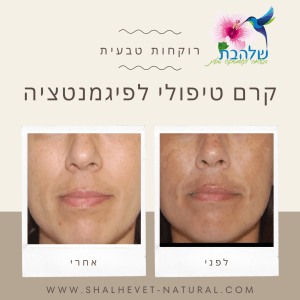 קרם הבהרה לפנים ולגוף