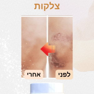 קרם לטיפול בצלקות